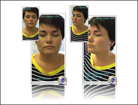 29-Katy Jobbins Permanent Makeup Perfect Powdered Effect With Natural Hair Simulation FI 29-Katy Jobbins Permanent Makeup Perfect Powdered Effect With Natural Hair Simulation FI