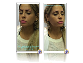 40-Katy Jobbins Permanent Makeup Perfect Powdered Effect With Natural Hair Simulation FI 40-Katy Jobbins Permanent Makeup Perfect Powdered Effect With Natural Hair Simulation FI