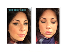 8-Katy Jobbins Permanent Makeup Over Last 10 Years Full Face 8-Katy Jobbins Permanent Makeup Over Last 10 Years Full Face