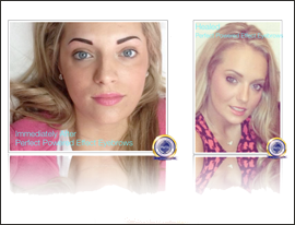 123-FI-Katy Jobbins Permanent Makeup Trichotillomania eyebrow client after permanent makeup