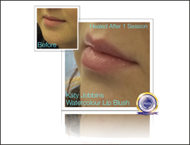 70-FI-Katy Jobbins Permanent Makeup Natural Watercolour Lip Blush