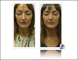 91-FI-Katy Jobbins Permanent Makeup Permanent Makeup 2nd Session Powered Effect Eyebrows